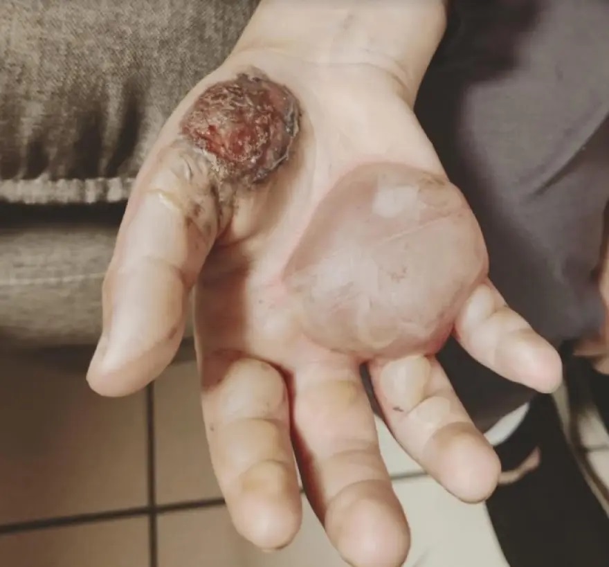 paidi-kakopoiisi-nea-smyrni.jpg paidi-kakopoiisi-nea-smyrni.jpg