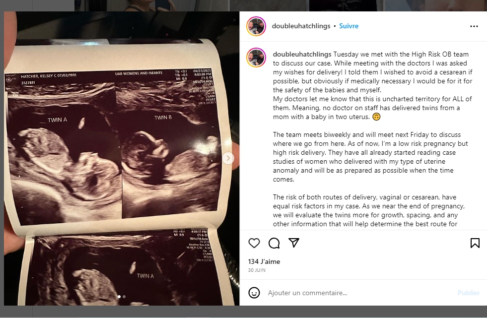 dipli mitra.jpg διπλη μητρα