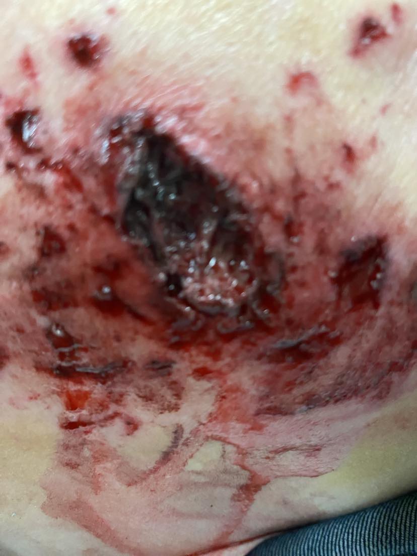 trafmatismos-diadilotrias-28-2-24.jpeg trafmatismos-diadilotrias