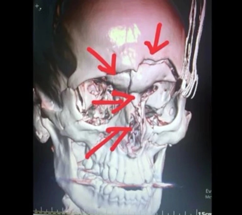 Ακτινογραφία