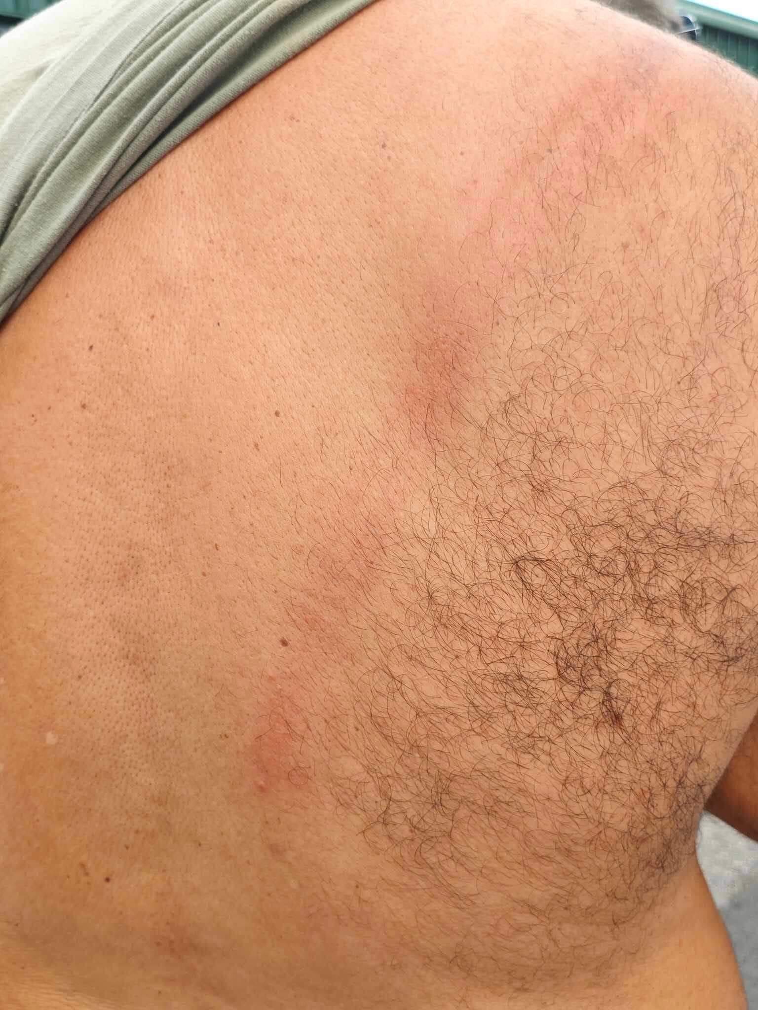 ekpaideytikoi_xylokopoyntai_2.jpg ekpaideytikoi_xylokopoyntai