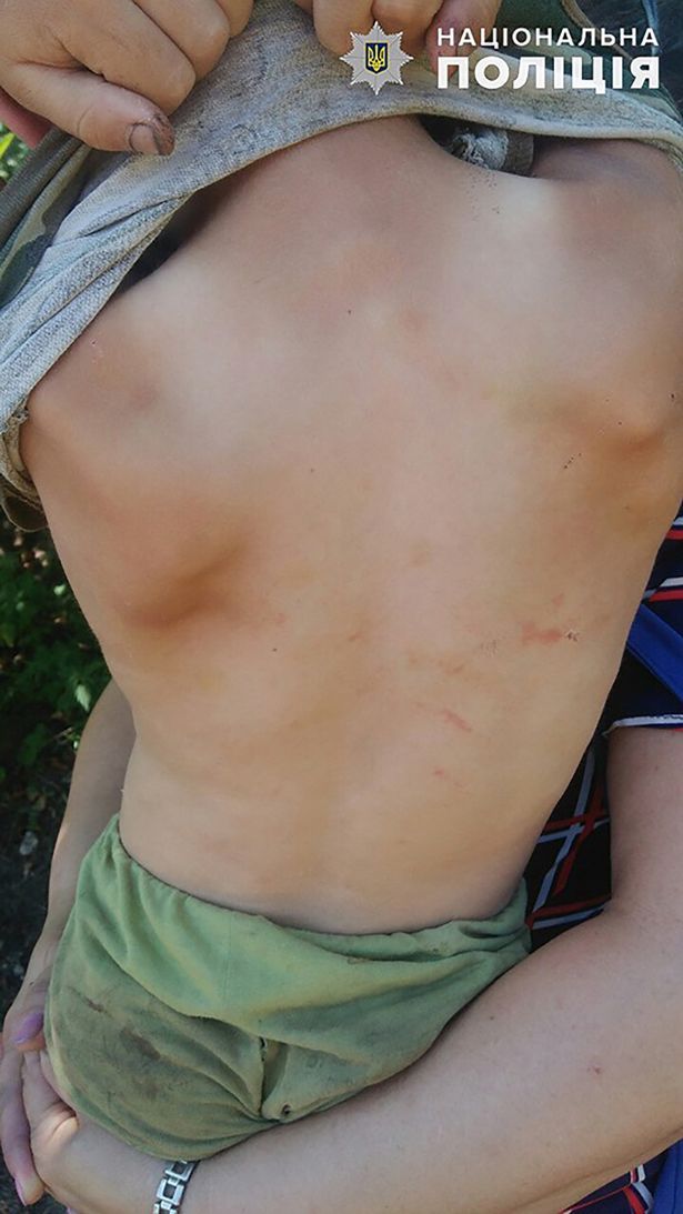 Κακοποίηση ανήλικου στην Ουκρανία