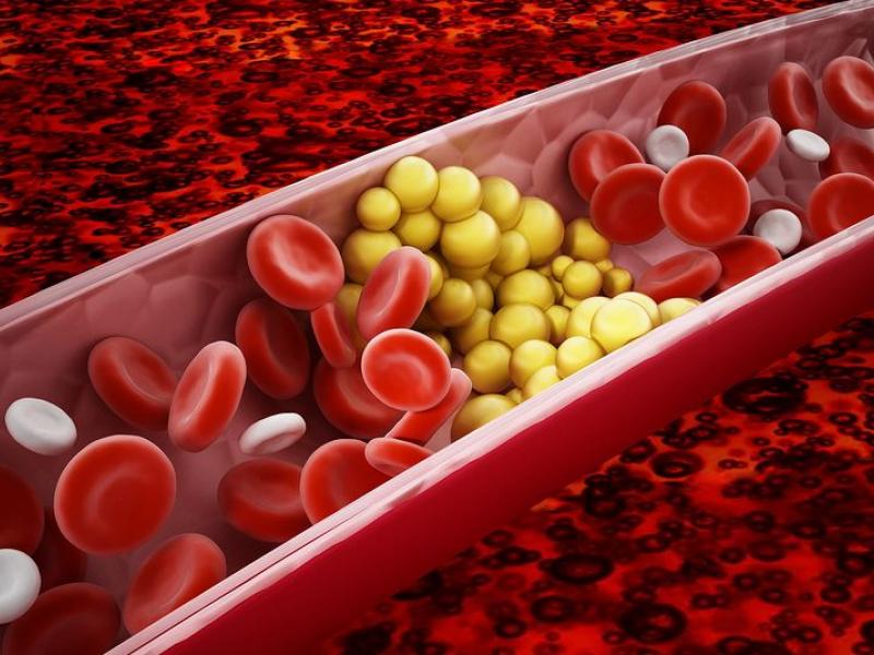 χολιστερινη