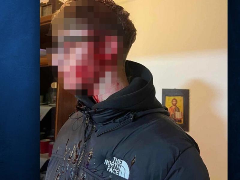 ξυλοδαρμός ανήλικος