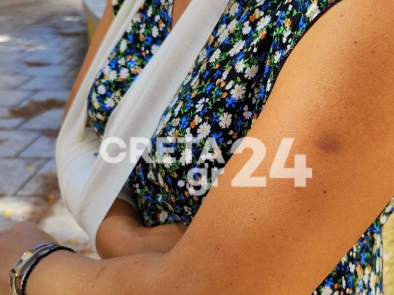 ξυλοδαρμος