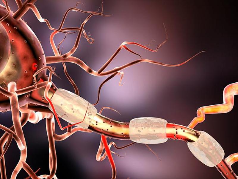 Σκλήρυνση κατά πλάκας