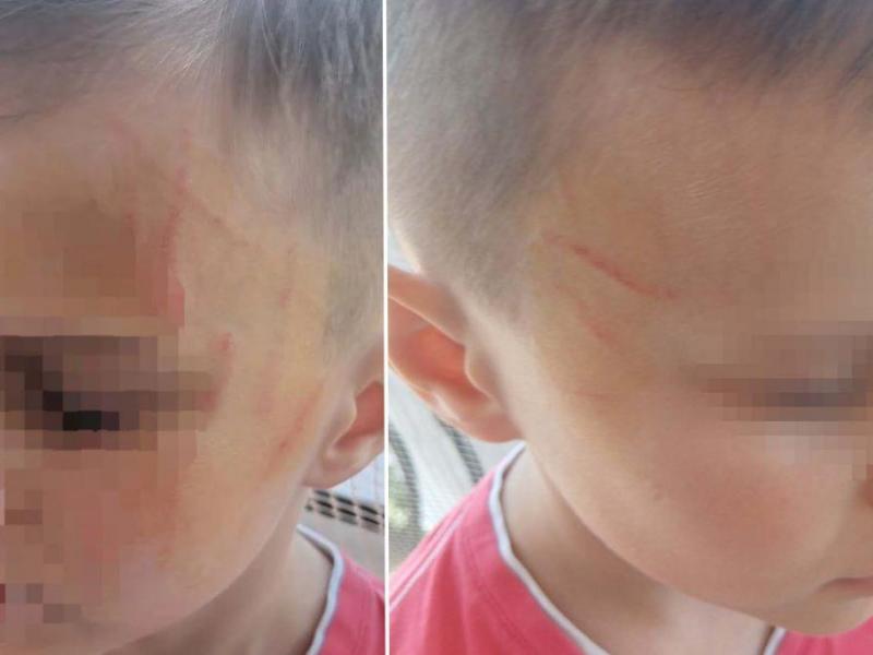 Επίθεση σε 5χρονο