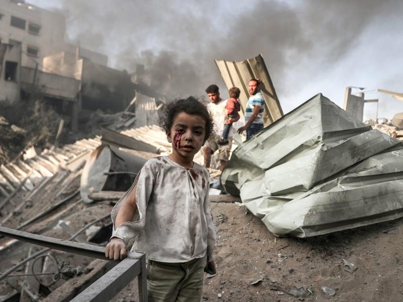 Τραυματισμένο παιδί στη βομβαρδισμένη Γάζα