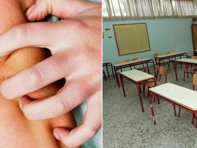 νορβηγική ψώρα