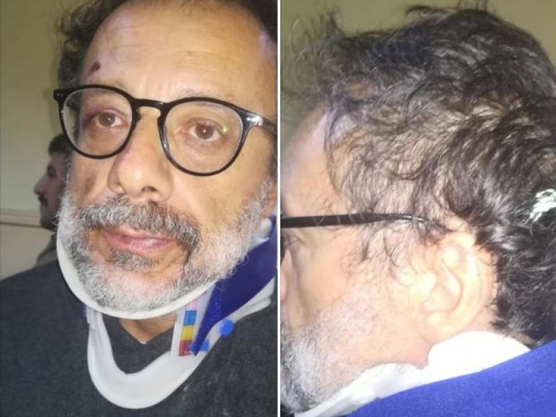 indares ragkousis anartisi