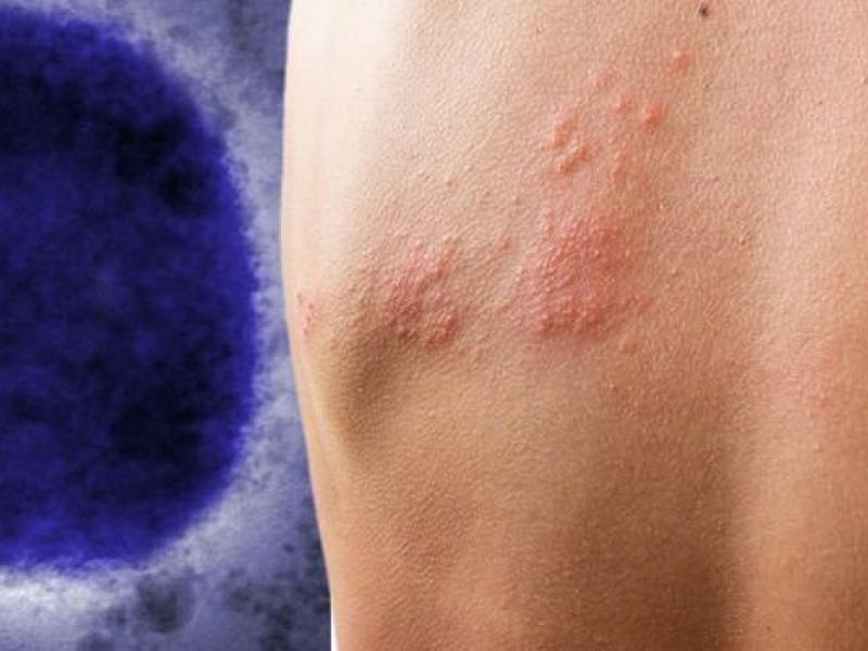 ευλογια πιθήκων 1.jpg