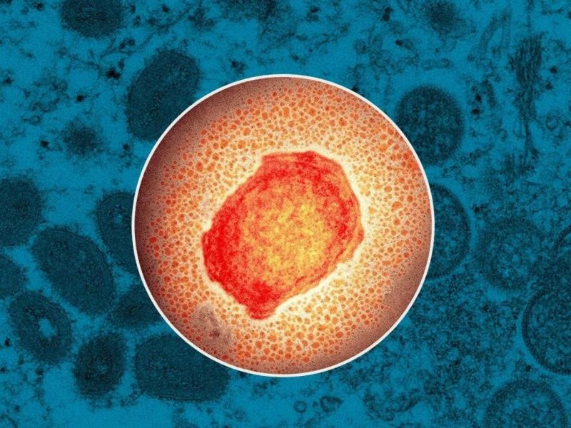 Ευλογιά των Πιθήκων