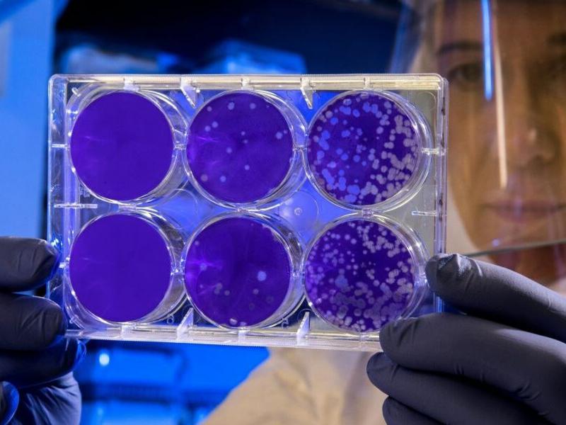 Εμφανίστηκε η θανατηφόρα νόσος Chagas