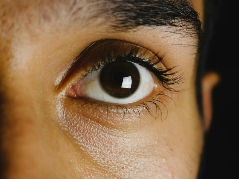 Κόκκινα μάτια