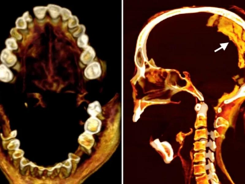 Μούμια που ουρλιάζει