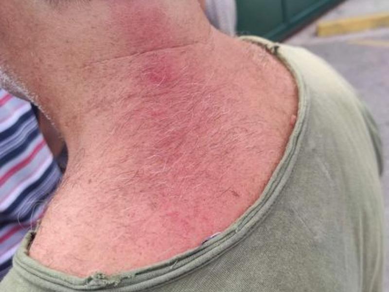 ekpaideytikoi xylokopoyntai