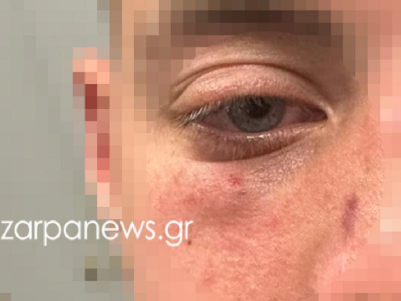 Ξυλοδαρμός μαθητών σε σινεμά