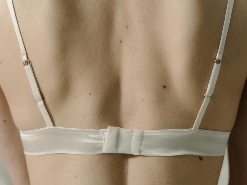 Ελιές στο δέρμα