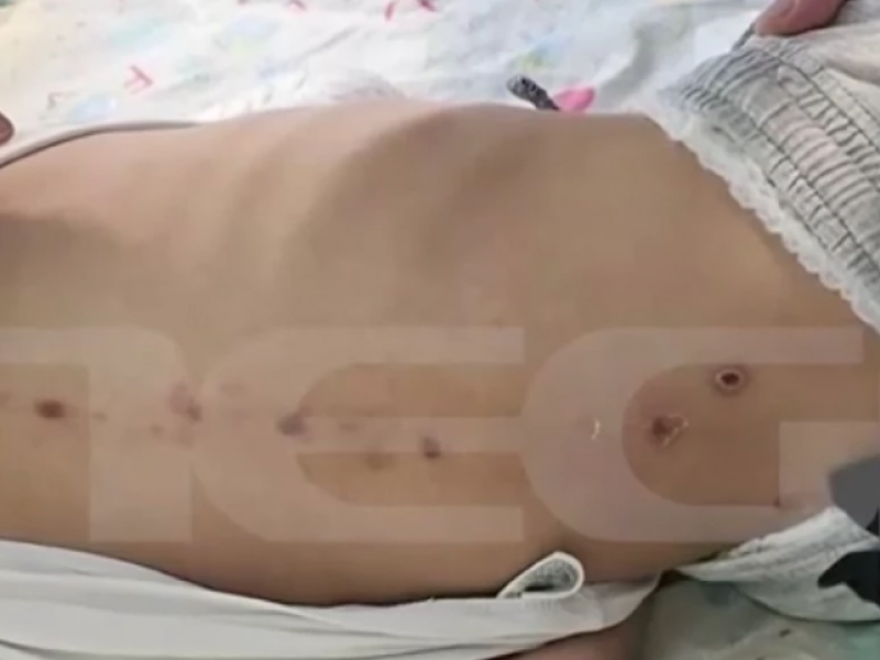 Κακοποίηση παιδιού