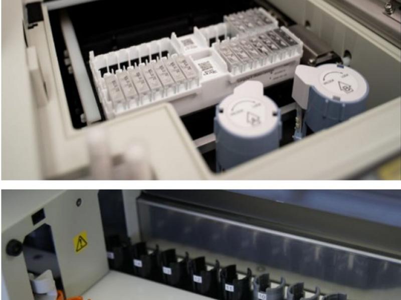 θεραπεία για αλτσχάιμερ