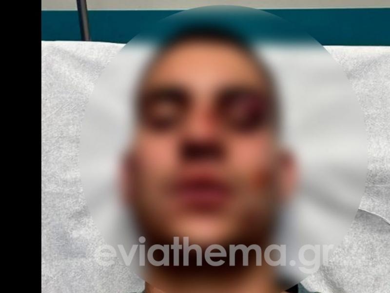 Ξυλοδαρμός στη Χαλκίδα