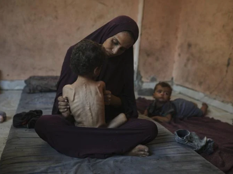Μητέρα κρατάει το υποσιτισμένο παιδί της στη Γάζα