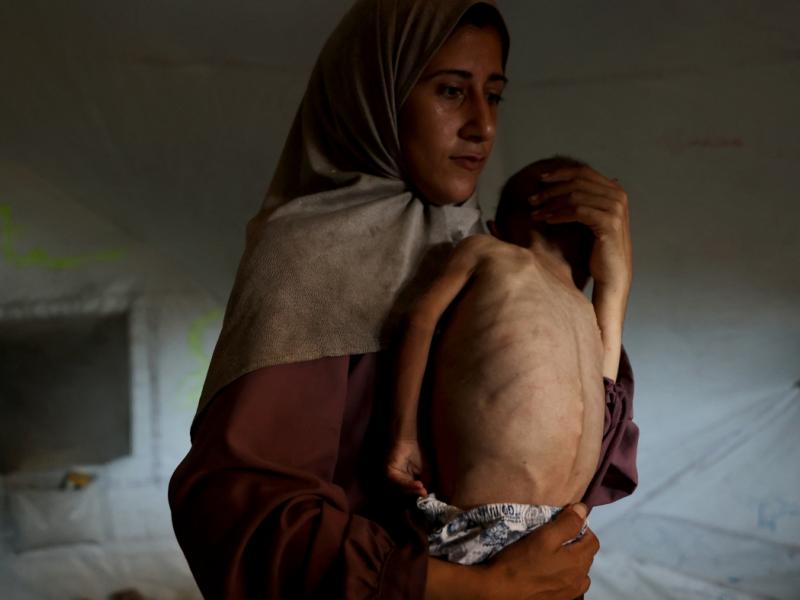 Λιμός στη Γάζα