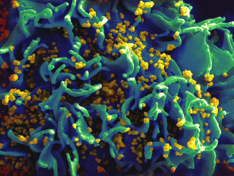 hiv_2.jpg