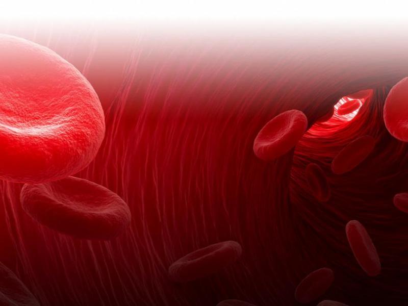 φλεβική θρομβοεμβολική νόσος