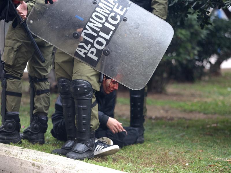 τραυματισμένος διαδηλωτής από ΜΑΤ