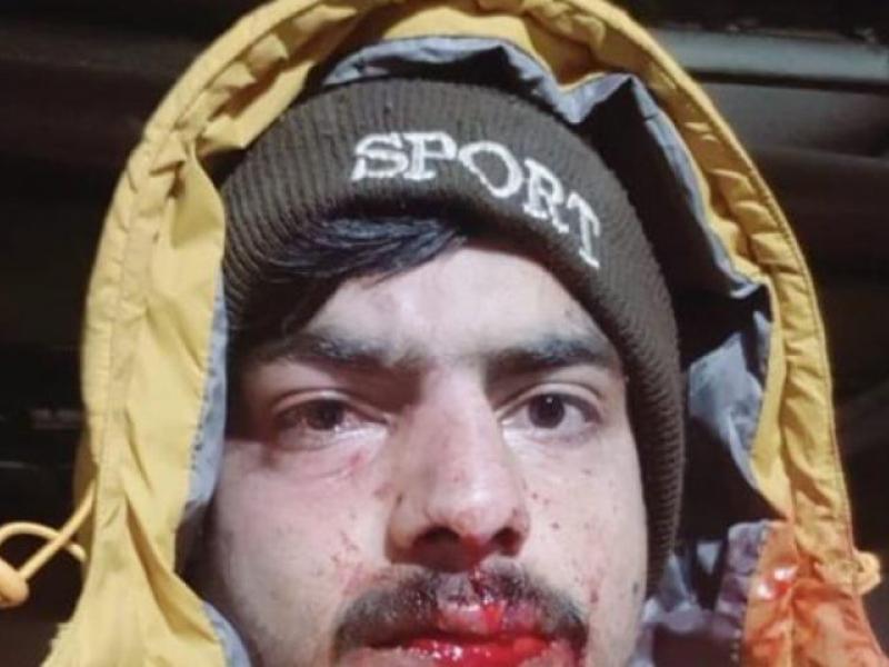 ξυλοδαρμος μεταναστες