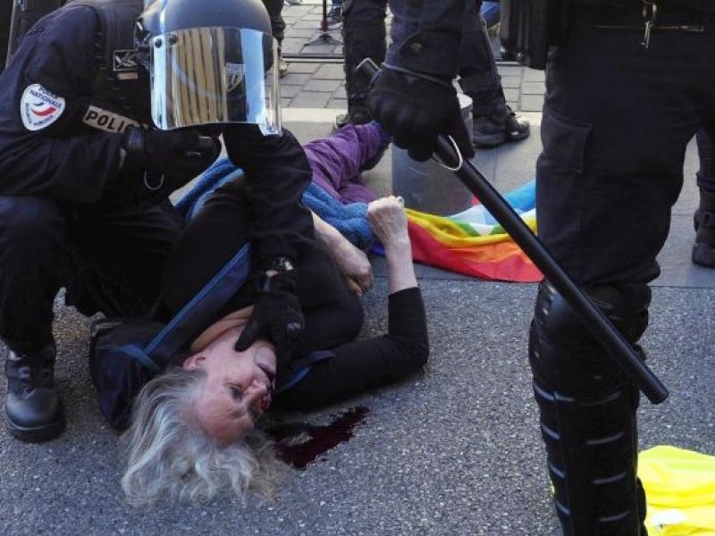 Τραυματισμός γυναίκας