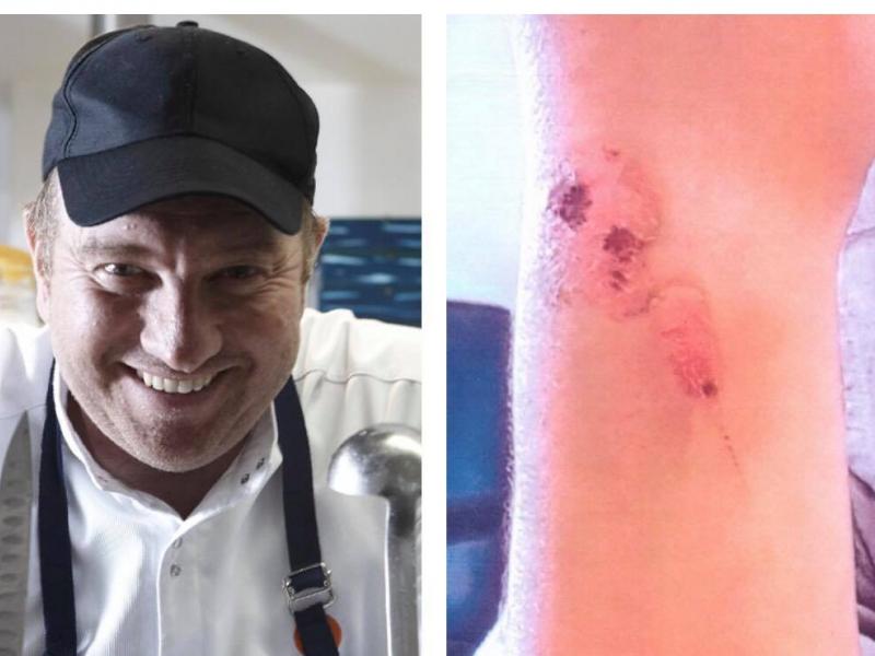 mpotrini kakopoiisi spoudastis