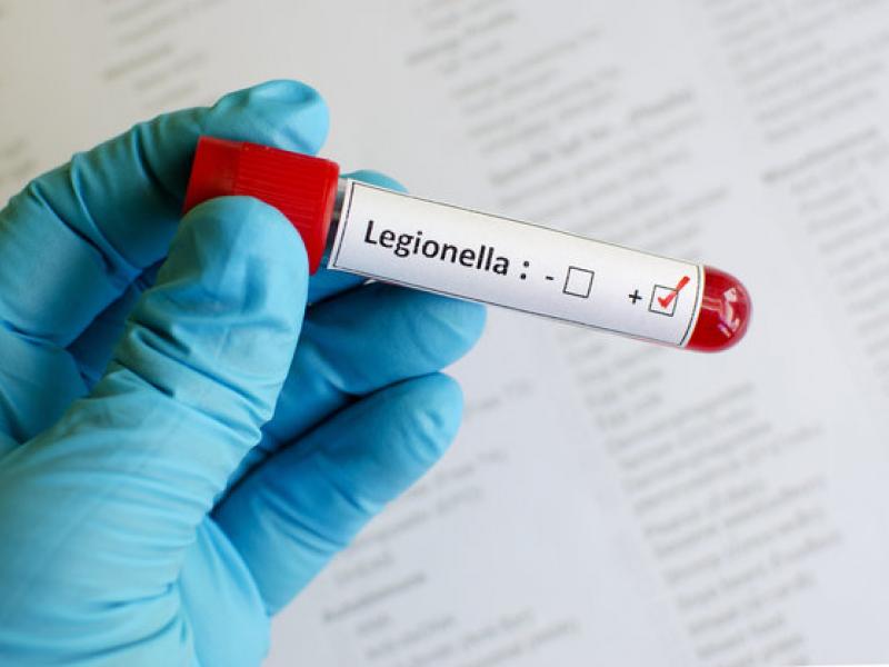 legionella.jpeg